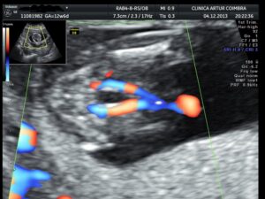 Ecografia Doppler - ClinicC Dr. Rui Coimbra