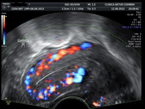 Ecografia Doppler - ClinicC Dr. Rui Coimbra