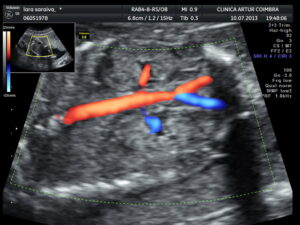 Ecografia Doppler - ClinicC Dr. Rui Coimbra