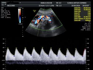 Ecografia Doppler - ClinicC Dr. Rui Coimbra