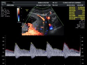 Ecografia Doppler - ClinicC Dr. Rui Coimbra
