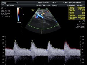 Ecografia Doppler - ClinicC Dr. Rui Coimbra