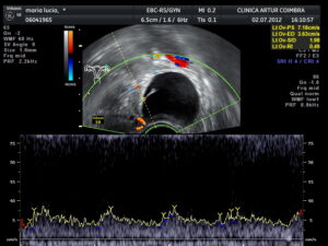 Ecografia Doppler - ClinicC Dr. Rui Coimbra