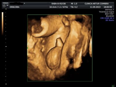 Ecografia 3D / 4D - ClinicC Dr. Rui Coimbra